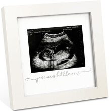 Fotormecek KeaBabies Baby Sonogram  modern ultrazvukov fotormecky pro maminku v prvnm tehotenstv drky pro nastvajc maminku a tatnka poprv