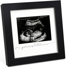 Fotormecek KeaBabies Baby Sonogram  modern ultrazvukov fotormecky pro maminku v prvnm tehotenstv drky pro nastvajc maminku a tatnka poprv