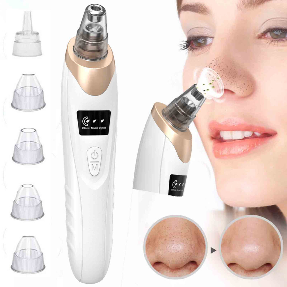 White (White) To Blackhead Artifact Beauty Pore Cleaner Blackhead Suction Instrument