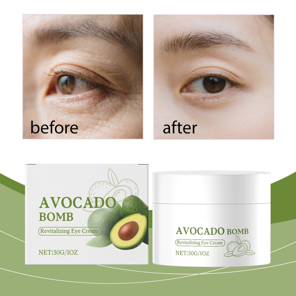 White/Cream () Aging Eye With Fine Lines Fading Moisturizing Wrinkle And Firming 30G