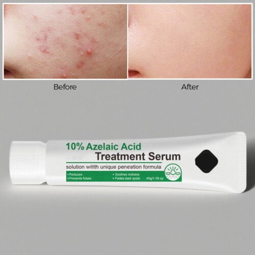 (Multicolor) Azelaic Face Serum 12 Percent Azelaic Serum Against Redness Rosacea Face Care Reduce Pigmentation 45g