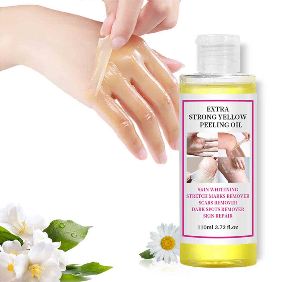 Yellow/Dark () Extra Strength Peeling Oil Knuckles Skin Whitening Dead Skin Exfoliating Spots Oil 30Ml/100Ml