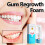 (Multicolor) Gums Regrowth Foam 30ml 1