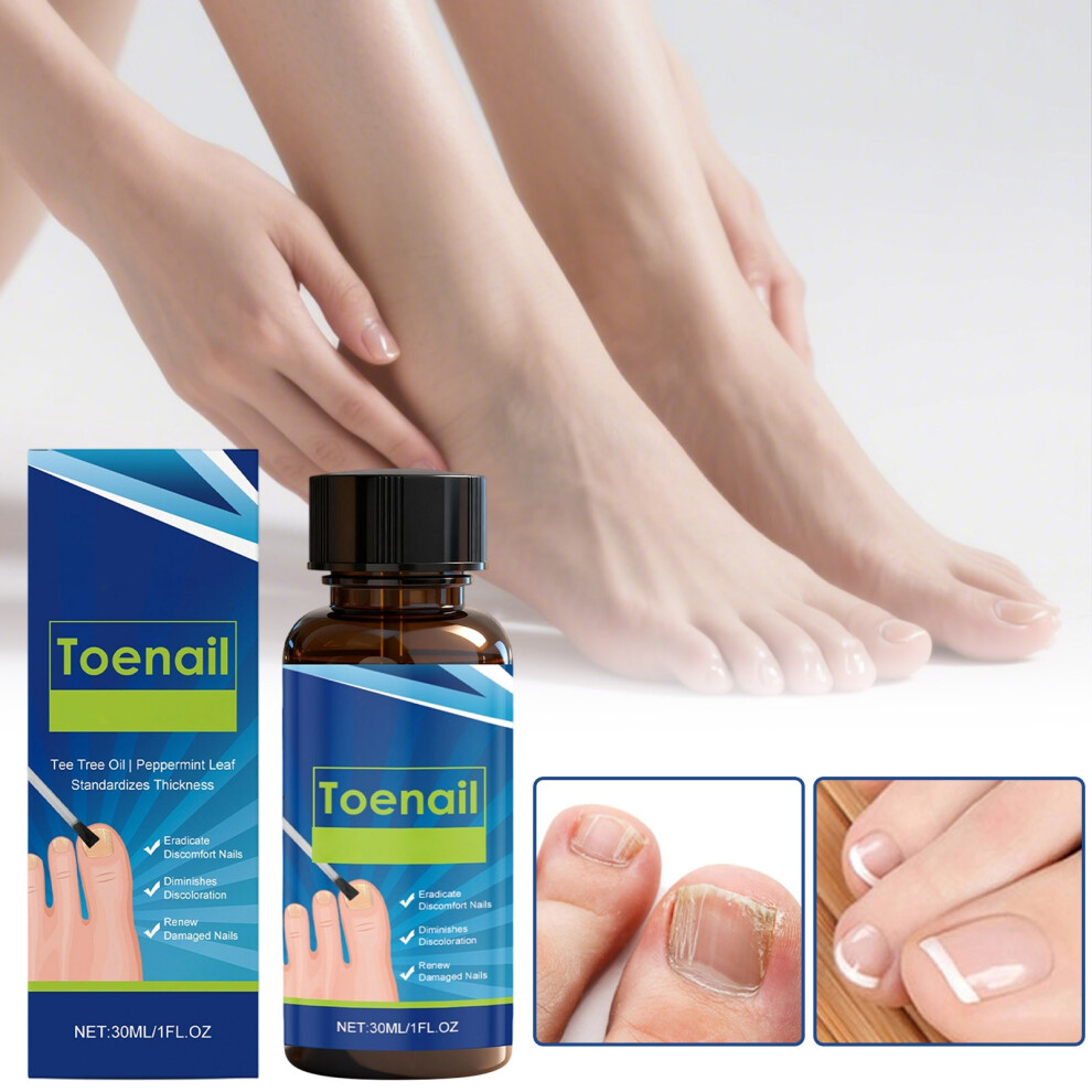 (Blue) Nail Strengthening Care Liquid Onychomycosis Care Toenail Soft Armor Thickening Repair Nail Polish Special Ingrown Nail Granulation Care 30ml