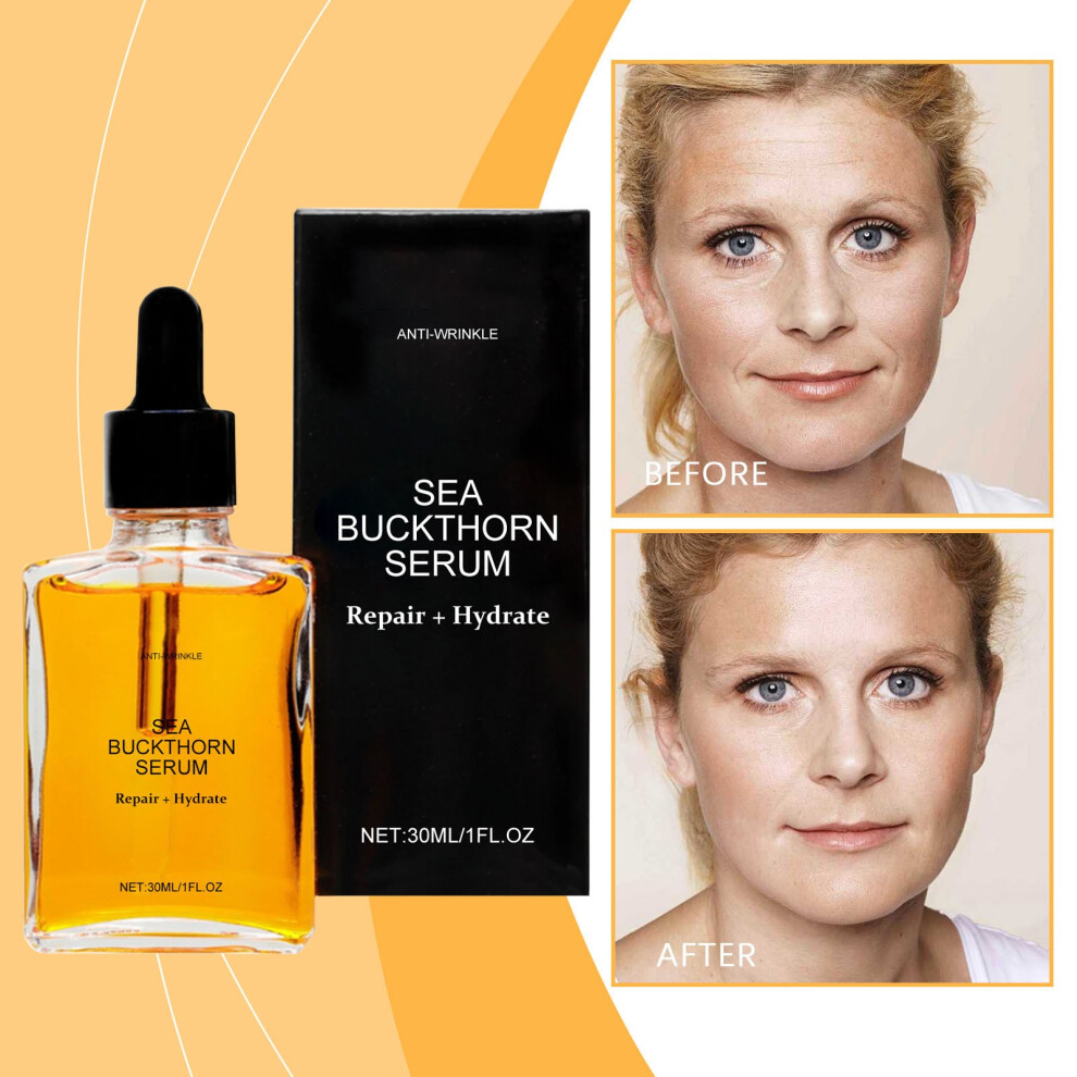 White (White) Seabuckthorn Wrinkle Moisturizing Moisturizing Replenishing And Wrinkle Improving Skin Texture Fading Fine Lines And Moisturizing 30Ml