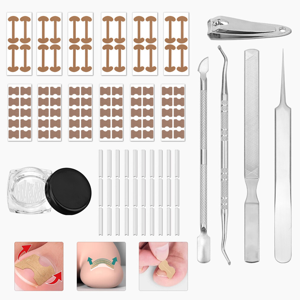 (Multicolor) Ingrown Toenail Set With Breathable Ingrown Toenail Strips Curved Toenails Corrector Patch File And Lifter Pedicure Tools For Women Man