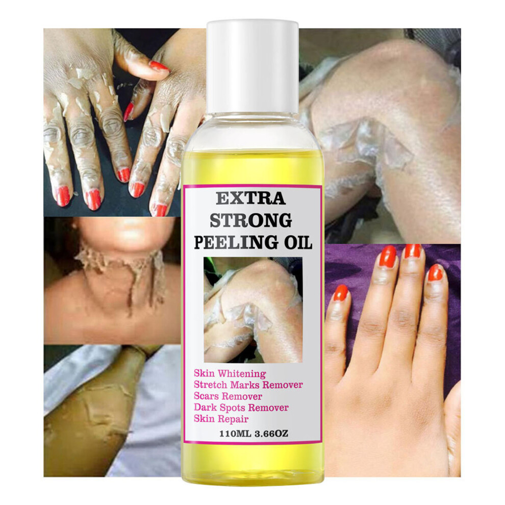 Yellow/Dark (Multicolor) Extra Strength Peeling Oil Knuckles Skin Whitening Dead Skin Exfoliating Spots Oil 110Ml