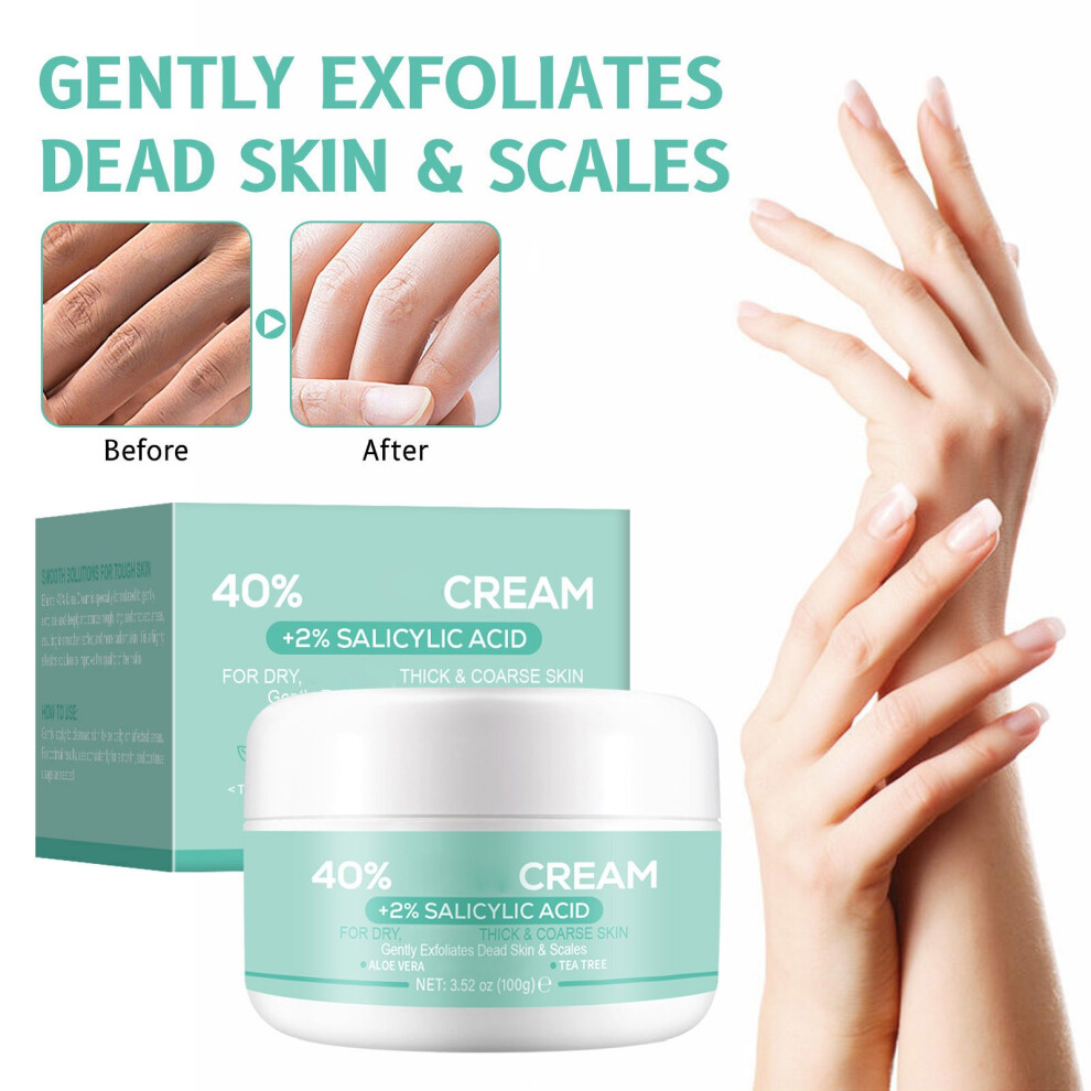 (White) Hand And Foot Moisturizing Cream Moisturizing And Soothing Dry Relief Care Lotion Brightening Body Oil 100g-image-OPC-PM9NWPQ-NEW