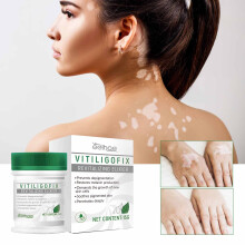 (White) White Vitiligo Cream Cream Psoriasis Localized Vitiligo Ointment Mycosis Leukoplakia