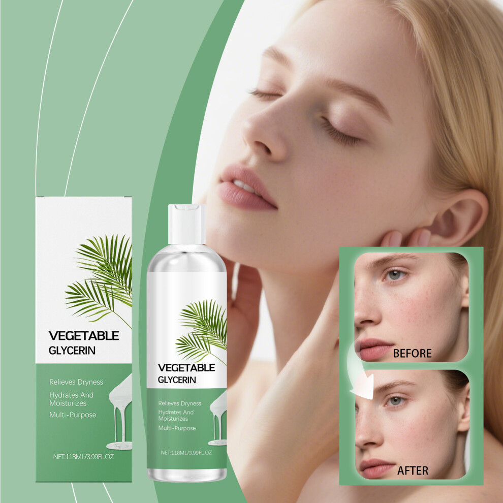(Multicolor) Moisturizing And Nourishing Glycerin Hydrating Firming Brightening Tone Relieving Dryness And Fading Spots Care Oil 118ml