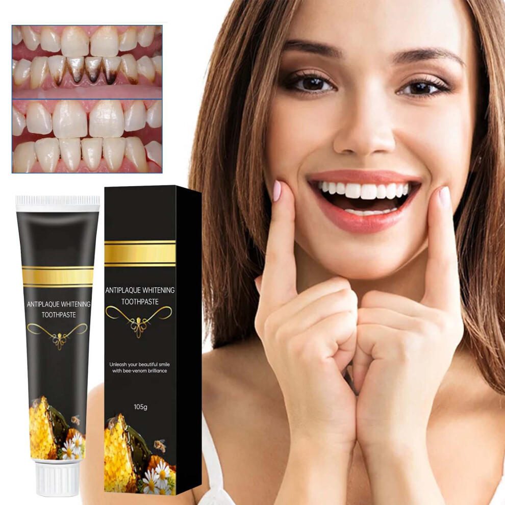 Black/Yellow () Stain Removal Toothpaste Stain Removal Brightening Improvement Toothpaste