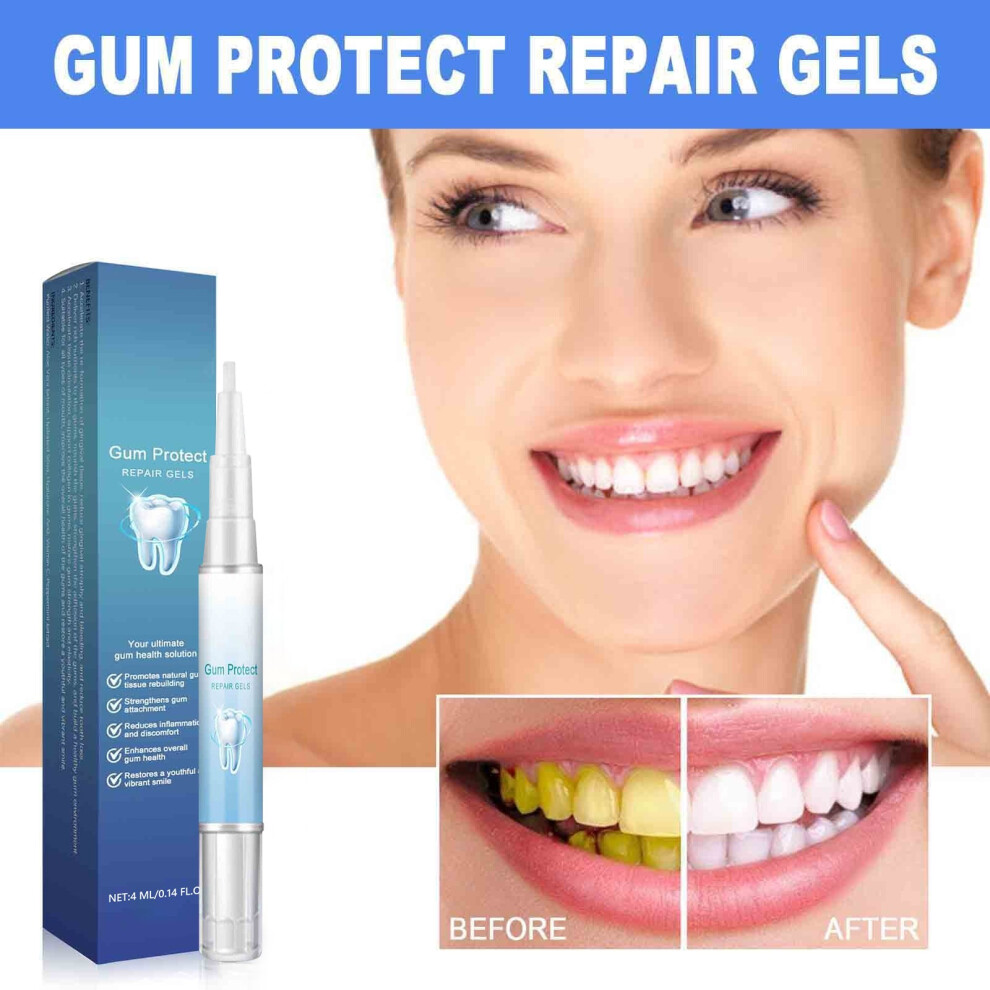 (C) Rotary Tooth Whitening Pen Tooth Whitener Whitening Tooth Whitening Pen 4.0ML