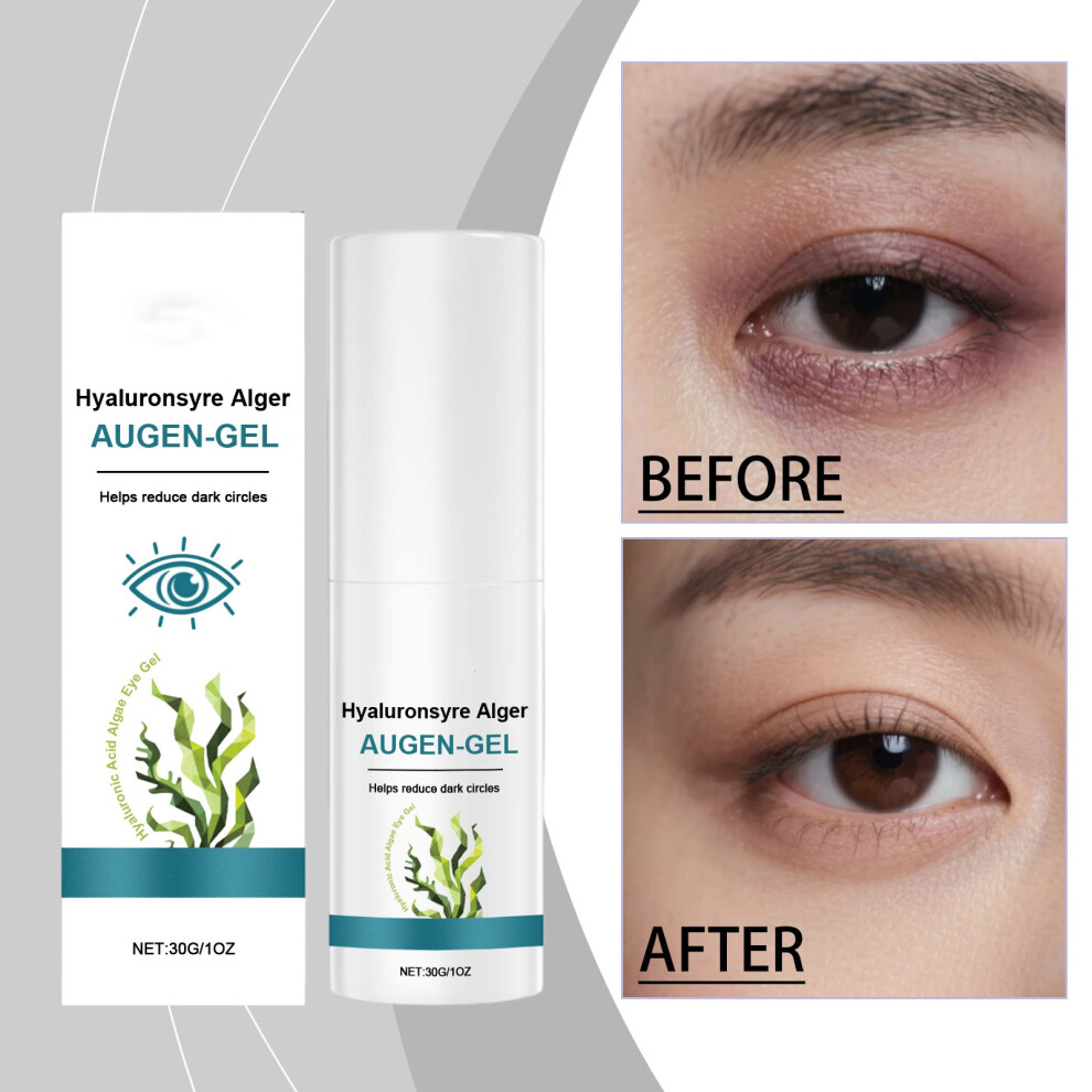 (White) Eye Care Gel Fine Lines Lightening Moisturizing Wrinkle Firming Eye Soothing Gel-image-OPC-PM9P2V2-NEW