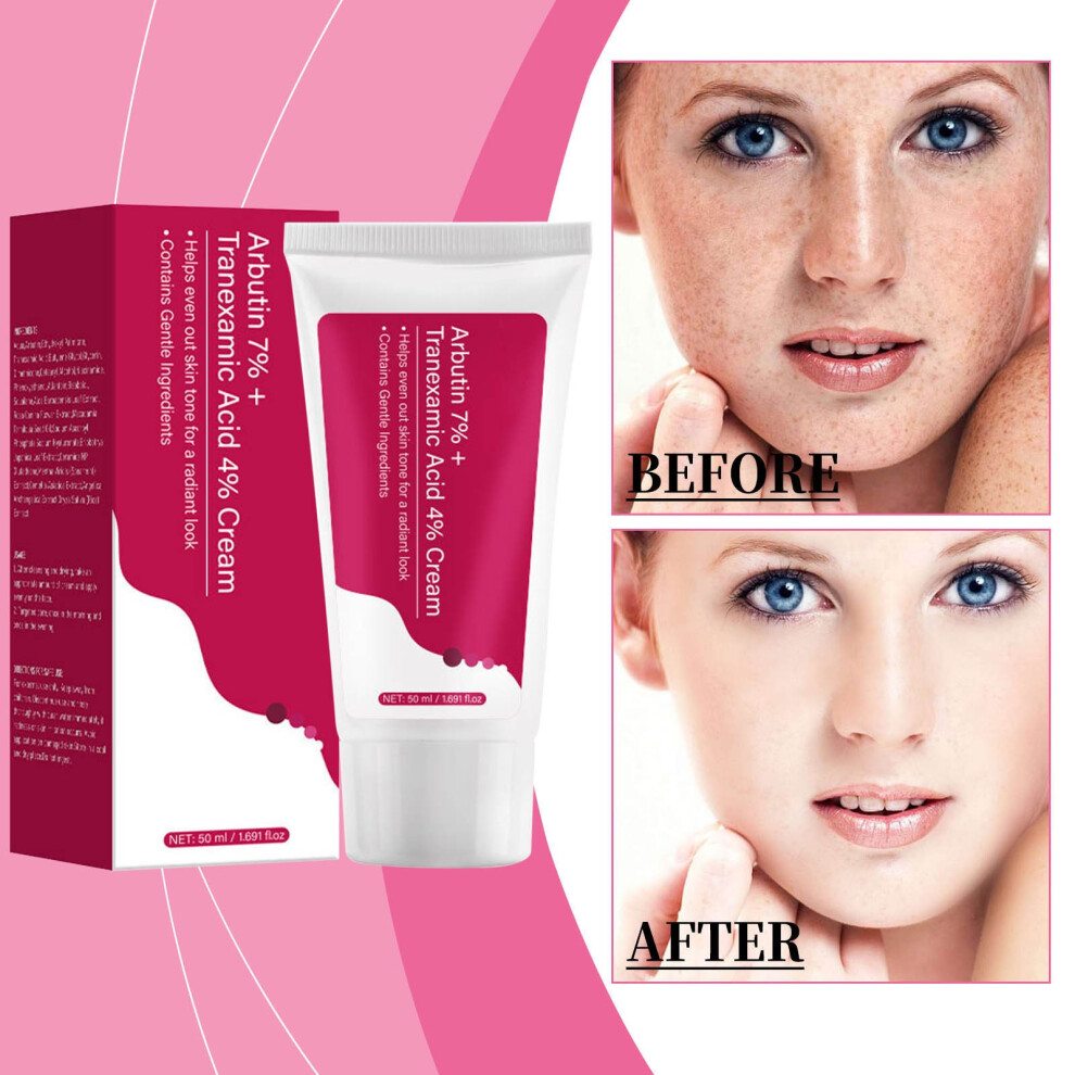 (Multicolor) Tranexamic Cream Face Cream For Dark Spots Freckle Blemishes Pigmentation Care For Hyperpigmentation 50ml