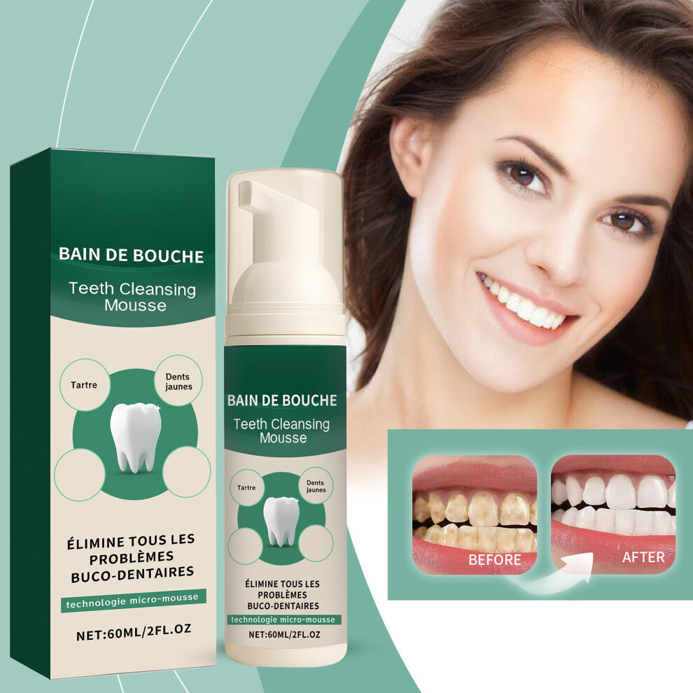 (Multicolor) Foam Tooth Cleaning Mousses Push-type Fresh Breath Oral Cleaning Care 60ml
