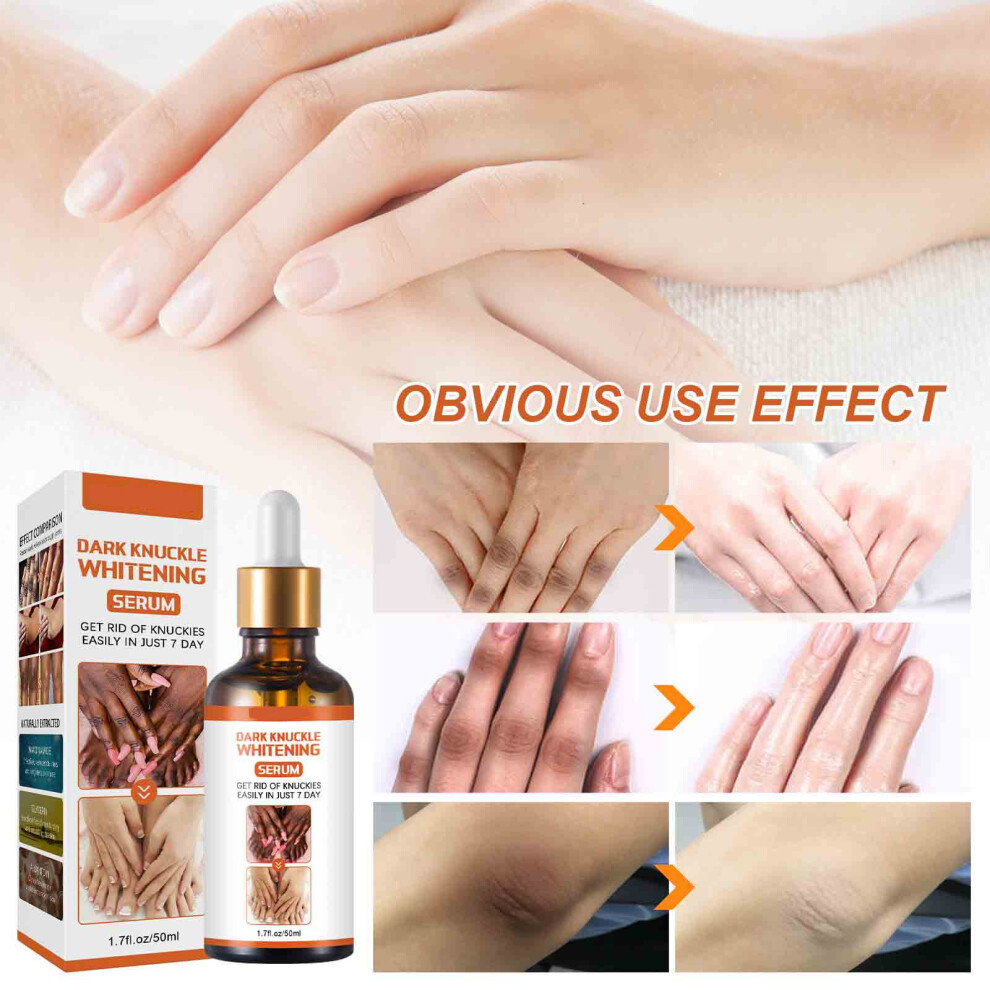 (Multicolor) Brightening Serum For Knee And Corner Melanin Brightening Tones Moisturizing Rejuvenation 50ML