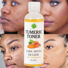 (Yellow) Dark Spots Eraser Turmeric Toner Skin Water Whitening Skin Whitening 100ml