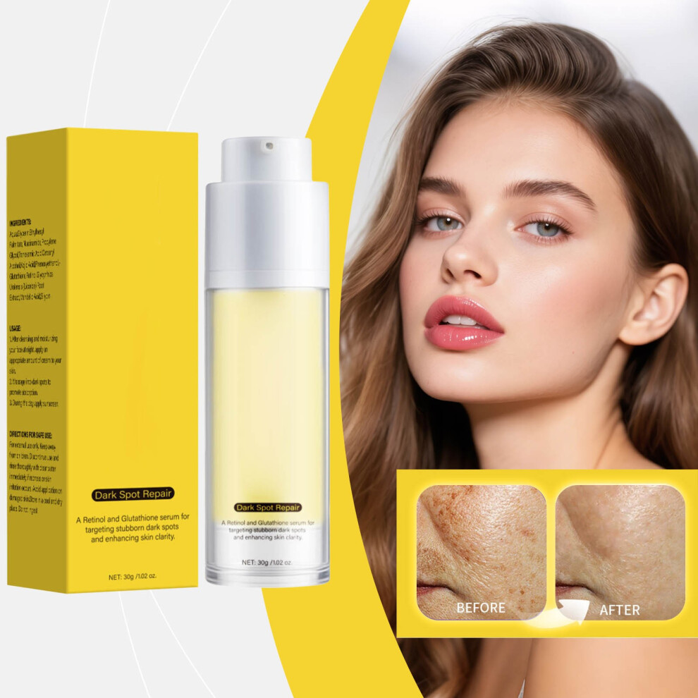 Yellow/Dark/Light () Spots Cream Discoloration For Face With Retinol Glutathione Mandelic And Tranexamic By Dermatologist 30G