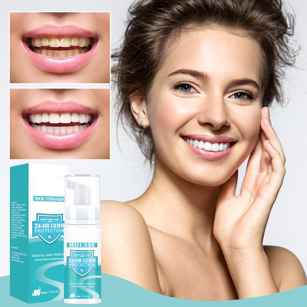 White (White) Teeth Ning Tooth Stain Removal And Booster Tooth Foam Toothpaste 50Ml