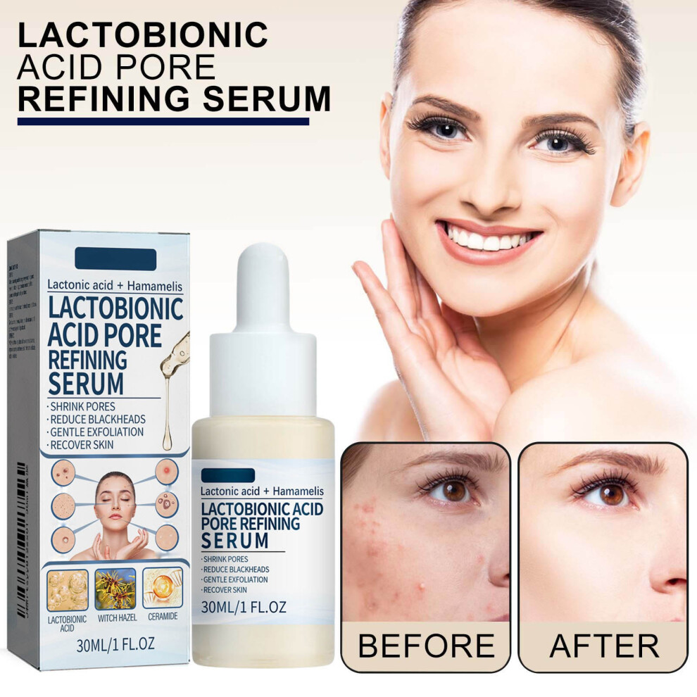 (Multicolor) Lactic Serum Exfoliating Blackhead Removing Pore Minimizing Nourishing Serum 30ml