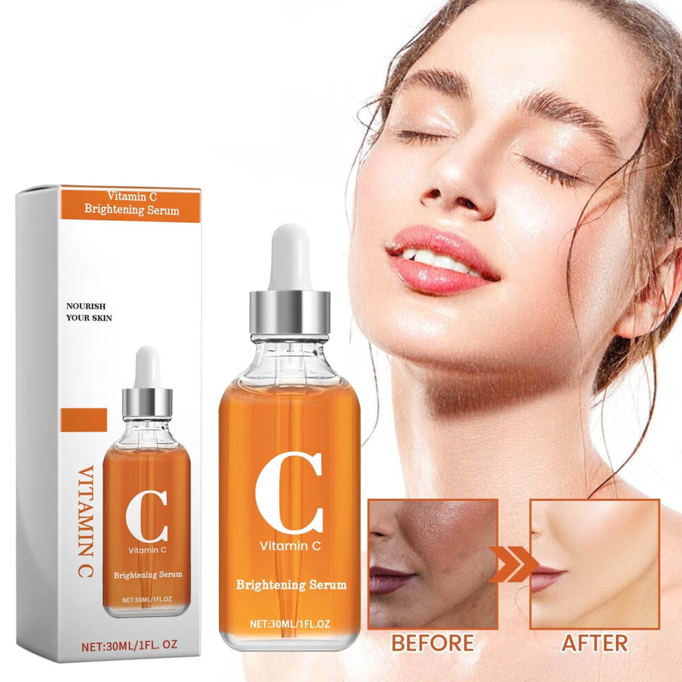 Orange (Orange) Vc Serum Mist Vc Moisturizing Mist For Face All Type For Men And Women 30Ml