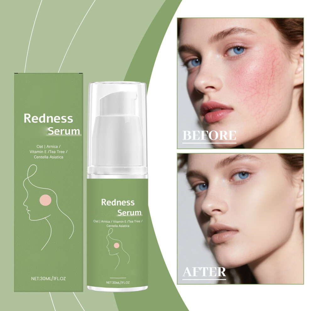 Green (Green) Moisturizing Brightening Preserving Wrinkle Essences 30Ml