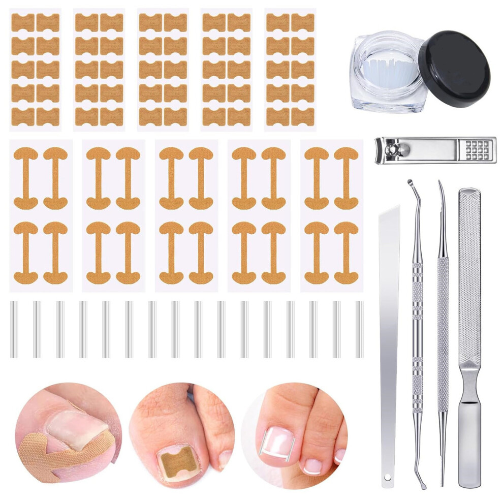 (Multicolor) Ingrown Toenail Set With Breathable Ingrown Toenail Strips Curved Toenails Corrector Patch File And Lifter Pedicure Tools For Women Man