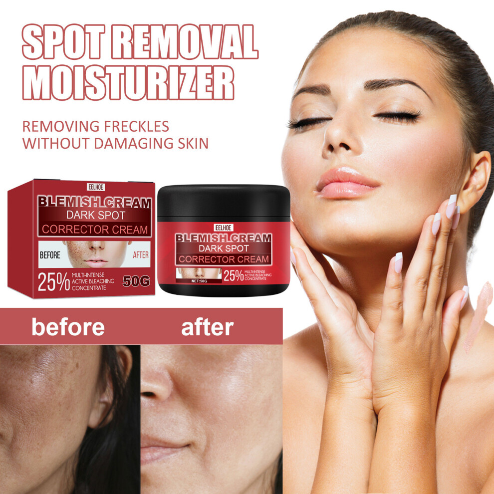 Red (Red) Lightening Moisturizer Depigmentation Melasma Freckles Moisturizing Brightening Tone Facial Hydration
