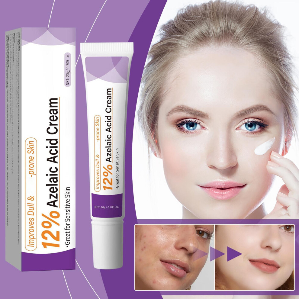 White/Cream/Dark () Azelaic 12 Percent For Relief Spots Facial Serum With Vitamin C Azelaic Serum For Excess Sebum Soothe Irritation 20G