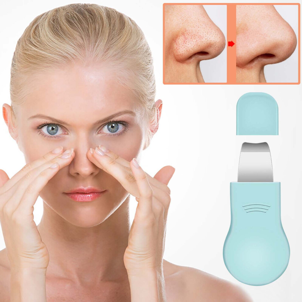 Blue (Blue) Facial Blackhead Shovel Deep Pore Tool