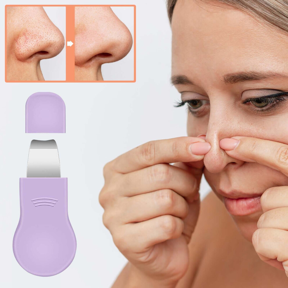 Purple (Purple) Facial Blackhead Shovel Deep Pore Tool