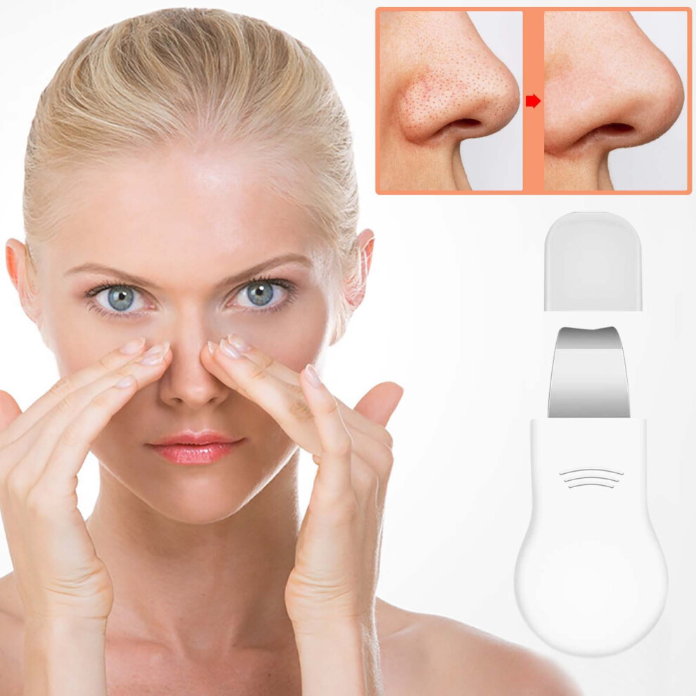 White (White) Facial Blackhead Shovel Deep Pore Tool