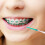 400 Pezzi Spazzolini Interdentali Per Profonda Denti 8