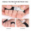 5St Elastic Pedicure Trenner 11