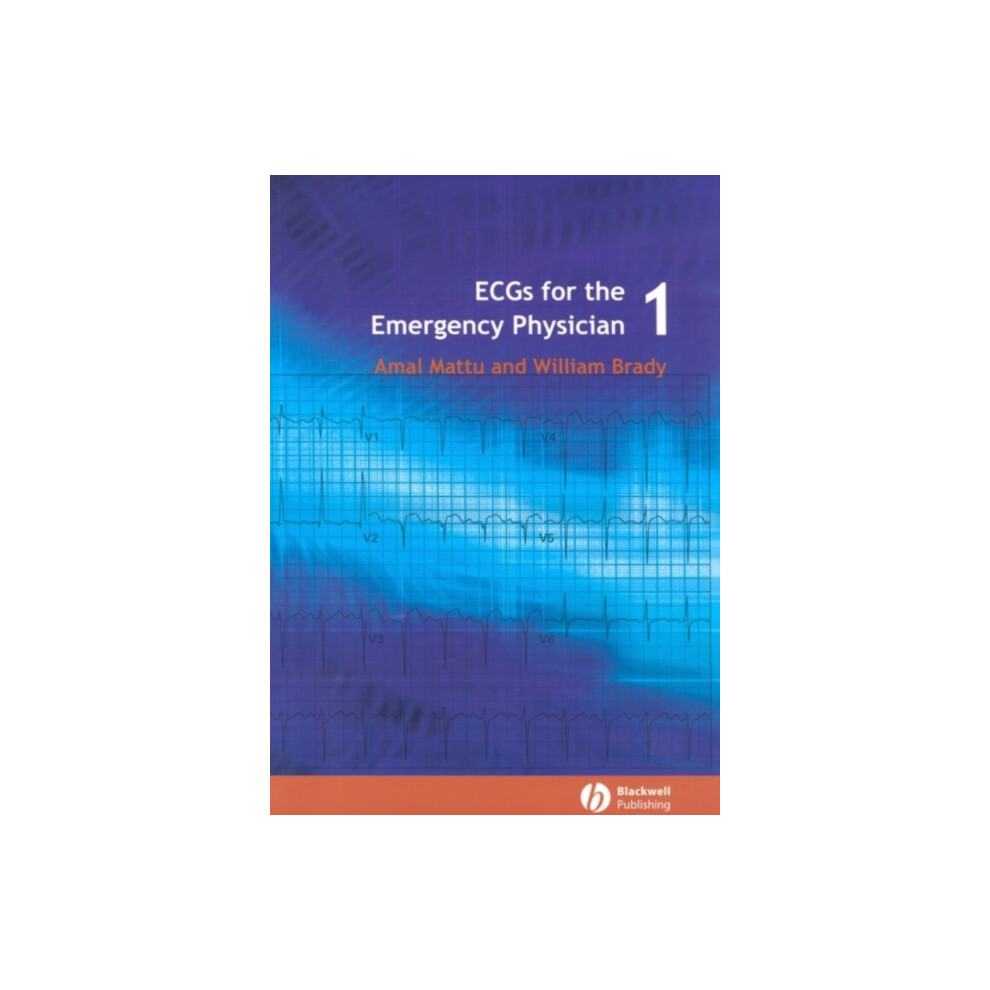 Riachristiecollections Ecgs For The Emergency Physician 1 By Amal Mattu Paperback Book