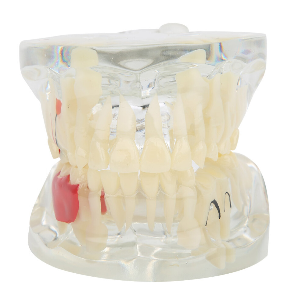 Deciduous Teeth Pathological Model Research Teaching Apparatus