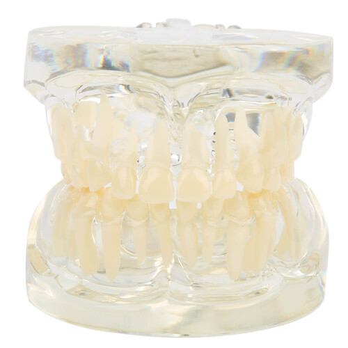 Clear Primary Deciduous Teeth Model for Kindergarten Lab Use 1