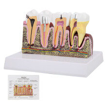 Zahnmodell für Anatomie & Kieferklinik