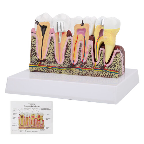 Zahnmodell für Anatomie & Kieferklinik
