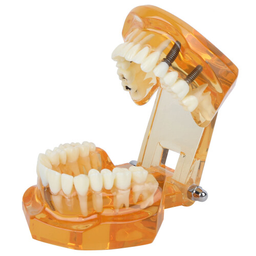 1x orange Zahnmodell zum Studium und Unterricht 2