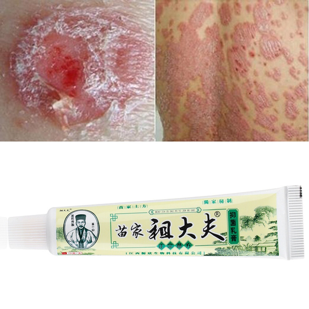 Cream Zudaifu 15G Chinese Medicine Antibacterial Eczema