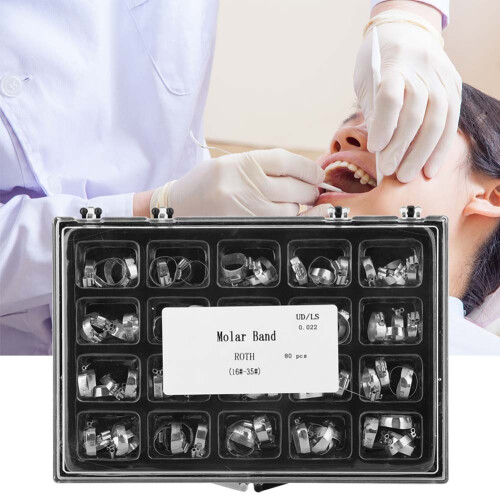80x Zahnspangen-Rohr-Molar-Band-Set 16#-35# 1