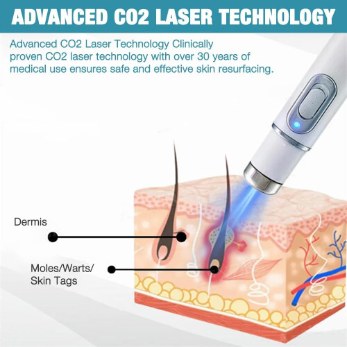 Non-Invasive Mole and Wart Removal Pen Mole Remover Pen Blue Light Dark Spot Remover Advanced Precision White 1