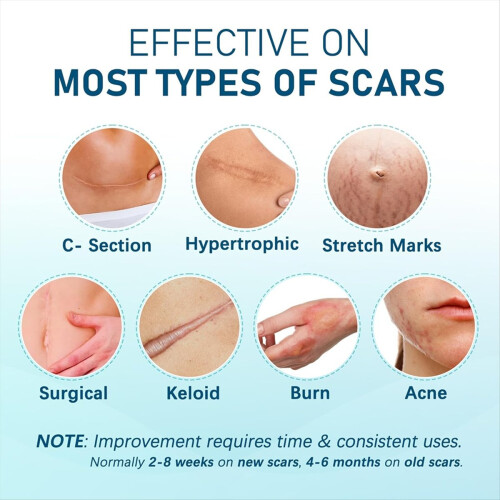 Silikone Cicatrix Masking Paste Silikone Tape 1