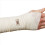 50 st elastiska bandage för stretch av metallklämmor 2