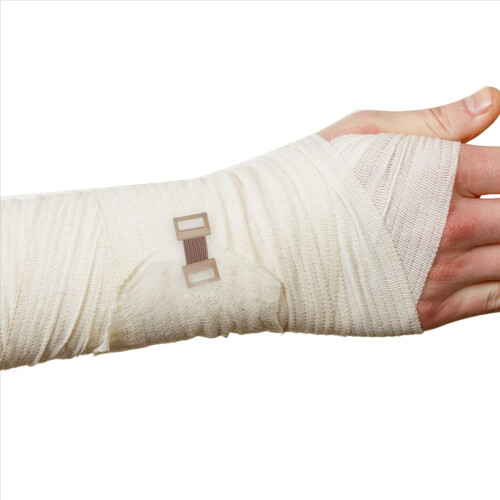 50 st elastiska bandage för stretch av metallklämmor 1
