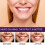 (2pcs) 3x 7-Pro Intensive Toothpaste - Advanced Natural Whitening Mint for Deep Stain Removal 5