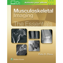 Musculoskeletal Imaging The Essentials by Felix S. Chew Hardcover Book