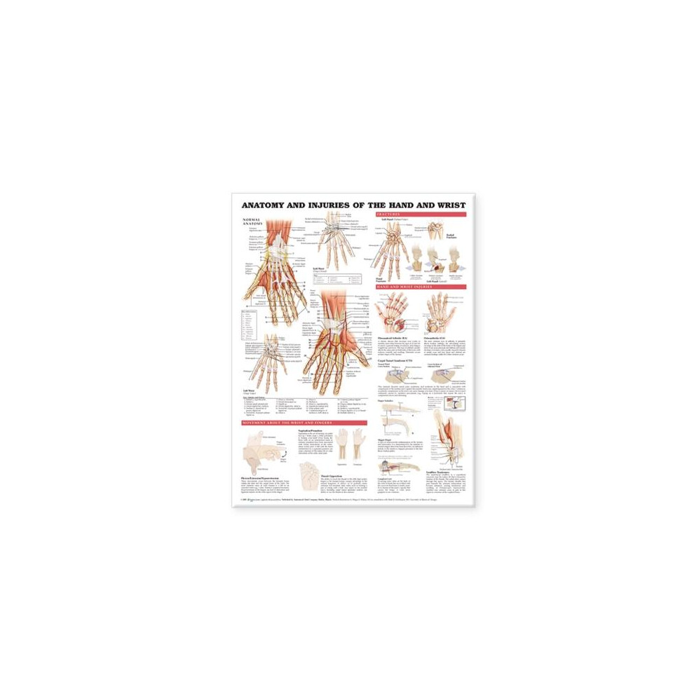 Anatomy and Injuries of the Hand and Wrist Anatomical Chart Other Book ...