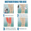Varicose Vein Massage Spray 1pc 3